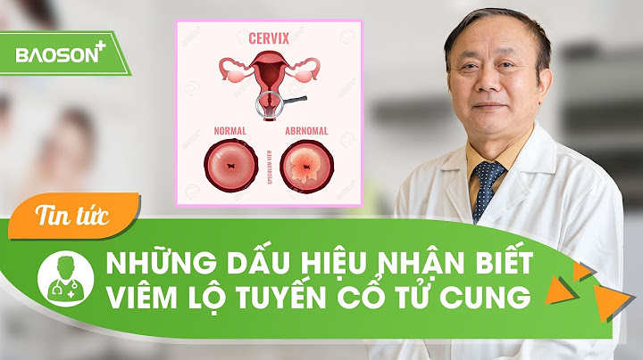 Dấu hiệu viêm lộ tuyến cổ tử cung là gì