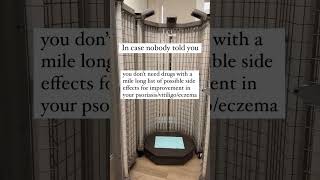 And here’s the best part (read description) #psoriasistreatment #vitiligotreatment #eczematreatment