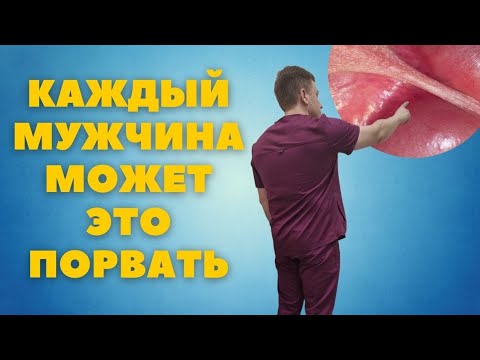 Уздечка полового органа // Что это? И почему столько бед от неё