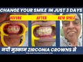 Brand New Smile In Just 3 Days With Zirconia Crowns From Dr. Praveen Bhatia! #smilemakeover