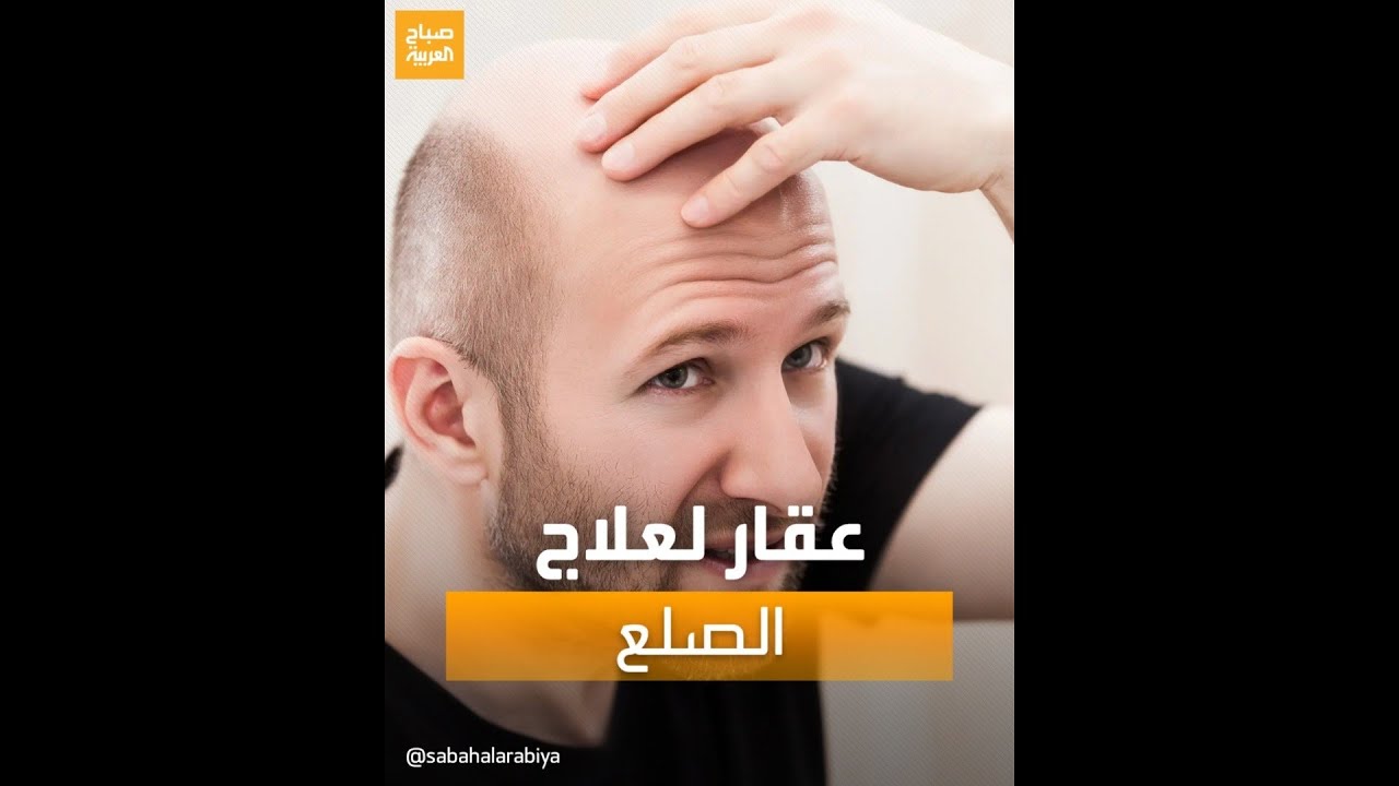 اكتشاف دواء جديد لعلاج الصلع يعيد نمو الشعر بالكامل خلال 6 أشهر