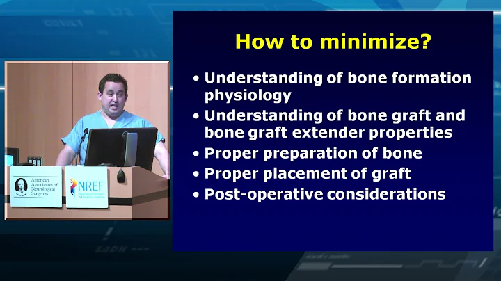 How to Achieve a Boney Fusion