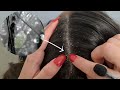 Asmr professional scalp cleansing microscope scratching dandruff relaxing