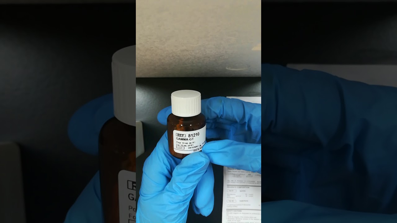 كيفية إجراء تحليل GGT مانيول عملي