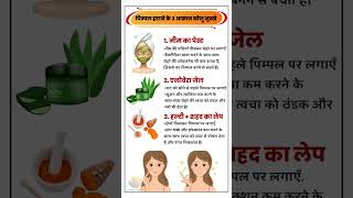 Pimple Hatane Ke 3 Easy Gharelu Nuskhe Face Care Tips