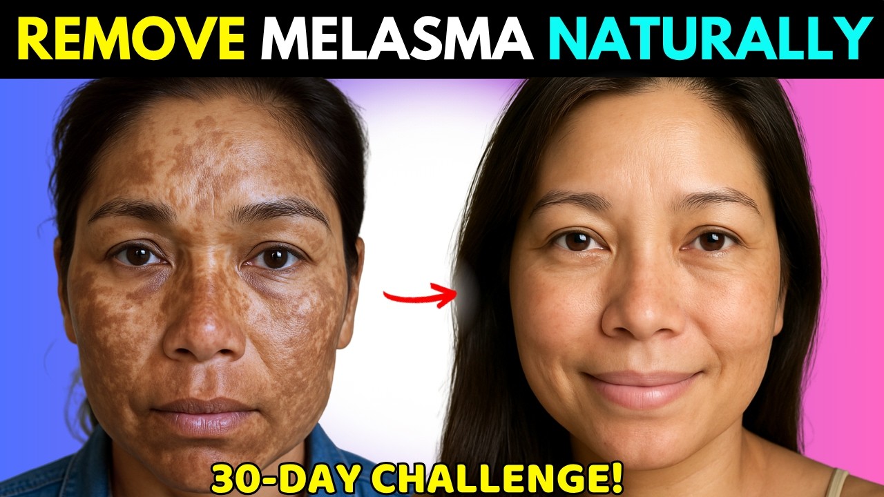 Единственная маска, которая вам нужна для удаления мелазмы, темных пятен и гиперпигментации