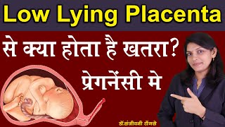 Low Lying Placenta से क्या होता है खतरा? प्रेगनेंसी में II placenta previa during pregnancy Hindi