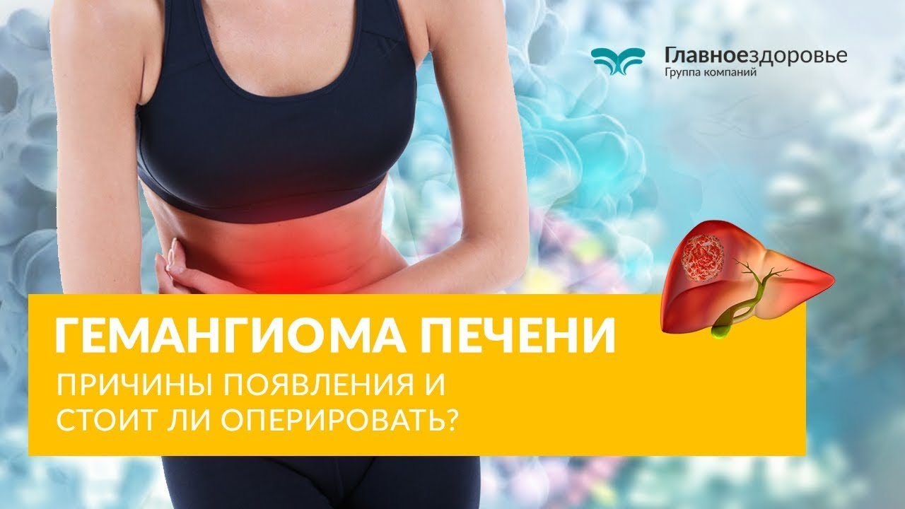 Гемангиома печени. Причины появления и стоит ли оперировать? - YouTube