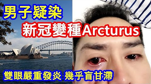 變種病毒 ! 泰男子疑染新冠變種Arcturus ! 雙眼嚴重發炎 幾乎盲甘滯 ! 咳嗽噴鼻血 快窒息甘滯 - 天天要聞