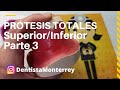 PASOS Prácticos #ProtesisTotales 👅Parte3 Placa base/Rodetes cera #DentaduraCompleta