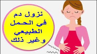 الافرازات الدموية او نزول دم اثناء الحمل متى يكون طبيعي ومتى يدل على وجود مشكلة فى الحمل