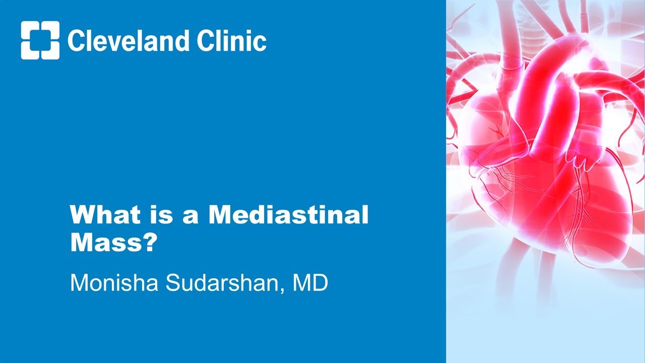 What is a Mediastinal Mass?