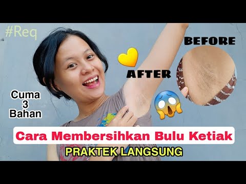 Cabut Bulu Ketek | shella ya