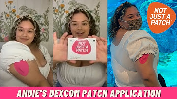 How to Easily Apply Dexcom Patches | Step by Step | Andie