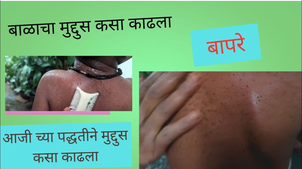 लहान मुलांचा मुद्दुस कसा काढायचा#👉👀🦠🦠#मुलींची शाळा🏢#trading##इन्फॉर्मेटीव##मुद्दुस##parimeenty#