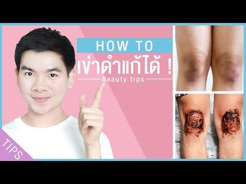 HOW TO แก้หัวเข่าดำทำไงดี วิธีแก้หัวเข่าดำ ได้ผลจริง ! l นุชา HAPPY NUCHA