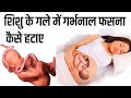 शिशु के गले में गर्भनाल फसना ,कैसे हटाए Umbilical Cord around baby neck in Hindi During Pregnancy