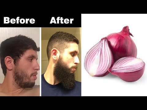 How To Grow Beard Faster Naturally At Home For Teenager | Beard Growth Home Remedy