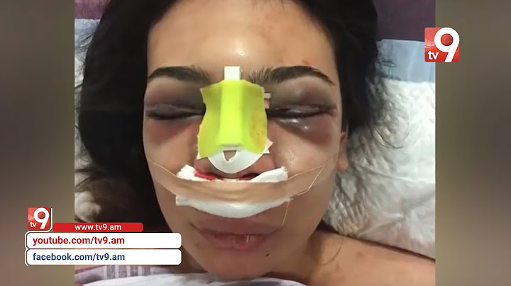 Ո՞վ է գլխավոր մեղավորը