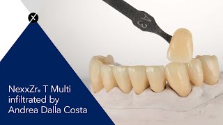 Sagemax Experience Nexxzr T Multi Infiltrated By Andrea Dalla Costa