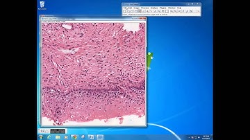 Trainable Weka Segmentation using Fiji