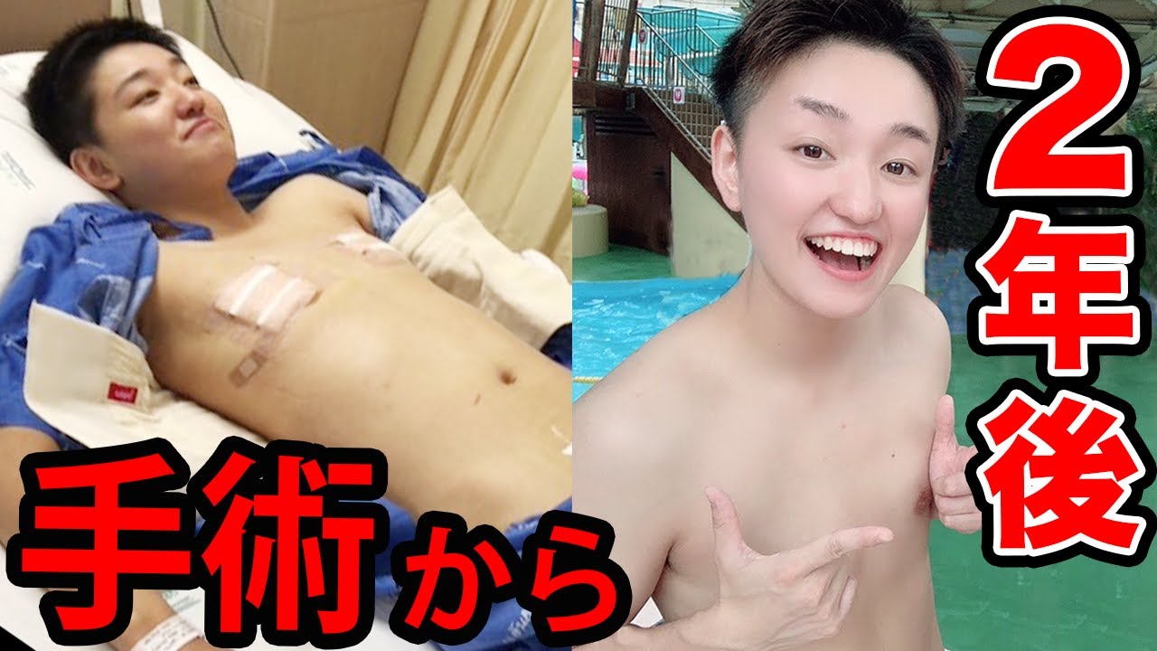 性 転換 女性 から 男性