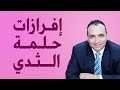 إفرازات حلمة الثدي 