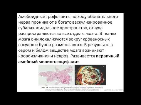 Виды почвенных  амеб. Неглерия и Акантомеба (Naegleria fowleri et Acanthamoeba castellani)