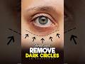 The best way to remove deep dark circles in photoshop  photoshop tutorial