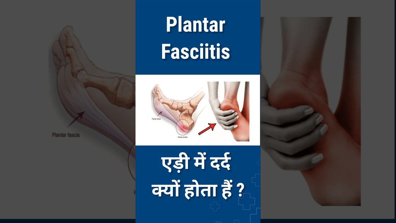Heel Pain / Plantar Fasciitis Causes | एड़ी दर्द के कारण