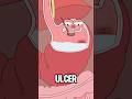 Why Can T You Drink Milk When You Have Stomachache Animation Funny Shorts Health Trending