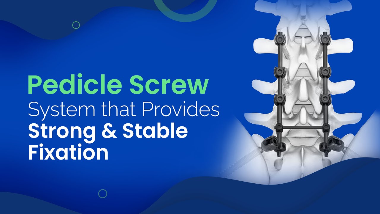 Pedicle Screw System for Strong and Stable Spinal Fixation | Zealmax Ortho