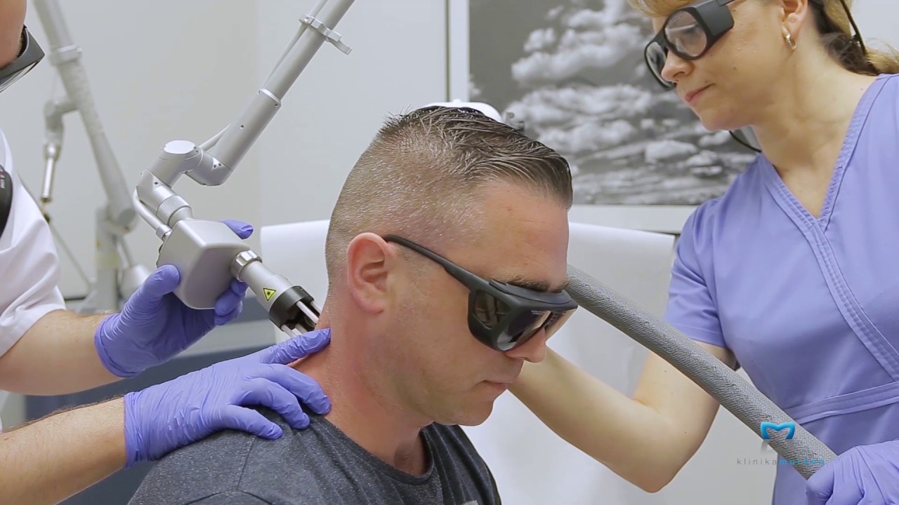 Laserowe Usuwanie Tatuażu - Klinika Murano Warszawa