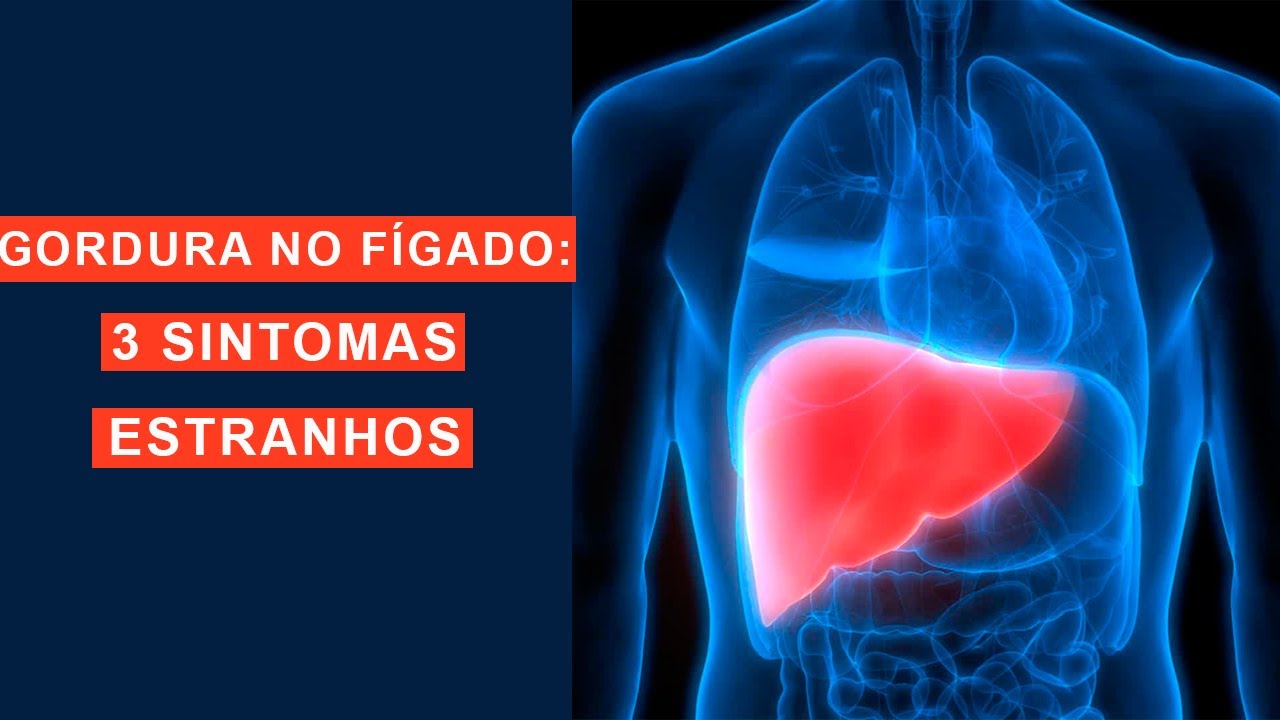 GORDURA NO FÍGADO (3 SINTOMAS ESTRANHOS) - YouTube