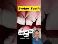Broken Front Tooth Here S How Dentists Restore Your Smile Dentallan Dentist Shorts Broken Front Tooth Here S How Dentists Restore Your Smile Dentallan Dentist Shorts