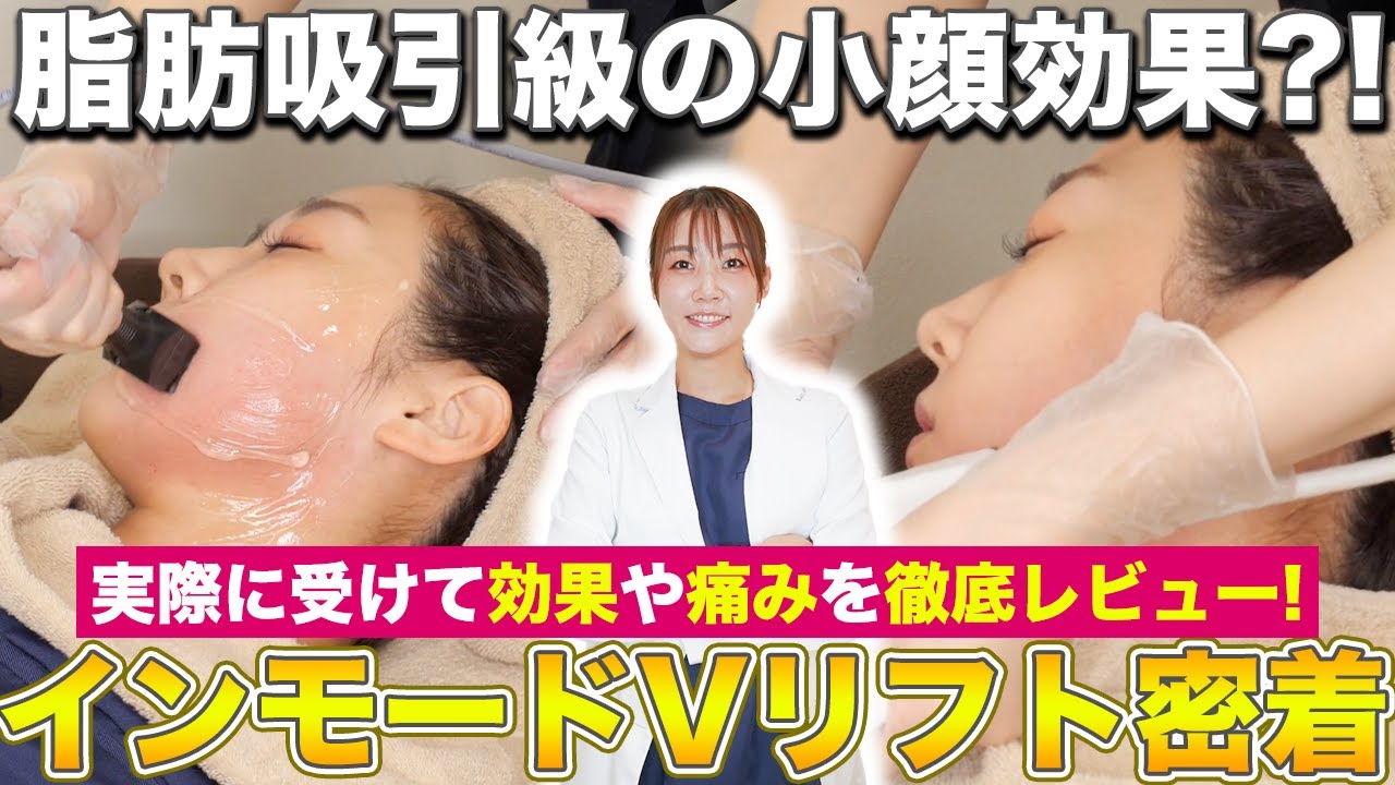 リバウンドなしで永久的な小顔効果！脂肪吸引級と噂のインモードVリフトの痛みや効果を実際に受けてレビューします！