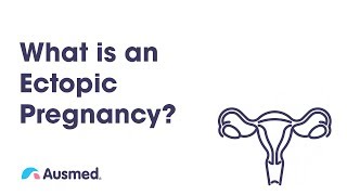 What is an Ectopic Pregnancy? | Ausmed Explains...