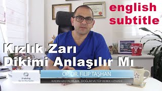 Kızlık Zarı Dikimi Anlaşılır Mı Jinekolog Op. Dr. Filip Taşhan - Nişantaşı, İstanbul - Himenoplasti