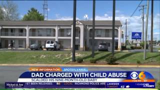 Watch Dad Charged With Child Abuse After Child Scalded