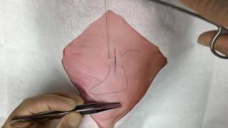 The Inverting Horizontal Mattress Suture
