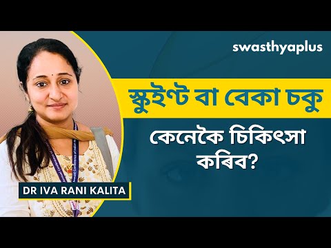 স্ট্ৰেবিচমাচ আৰু ইয়াৰ লক্ষণ | Treatment of Squint Eye / Crossed Eye in Assamese | Dr Iva Rani Kalita