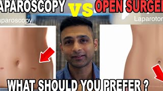 Laparoscopy versus open surgery . What should you prefer ?
