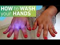 Handwashing and Hygiene Quiz