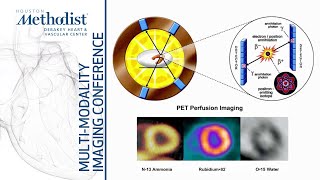Stress SPECT and PET: Methodology and Case Studies (F. Nabi, MD, M. Al-Mallah, MD) February 15, 2022