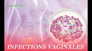 Infections vaginales : 5 mauvaises habitudes à proscrire - Top Santé