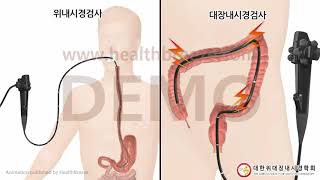 [시연용] b0009abko [대한위대장내시경학회][축약판]수면내시경검사 안내