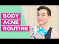 My ANTI-ACNE BODY ROUTINE! Affordable Drugstore Options for Chest &amp; Back Acne (Filipino)| Jan Angelo