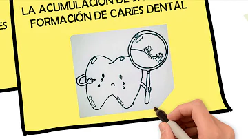 ¿Qué hay que hacer después de una limpieza dental?