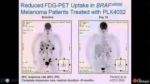 The use of emerging genomic technologies to predict tumor response and drug resistance