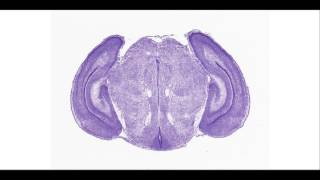 mouse brain - P1 coronal